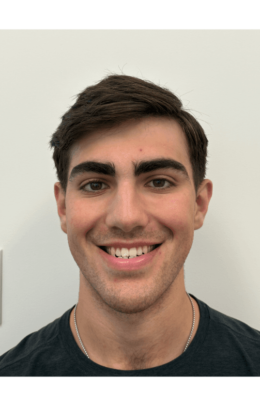 Before treatment — crowding case, 9 months